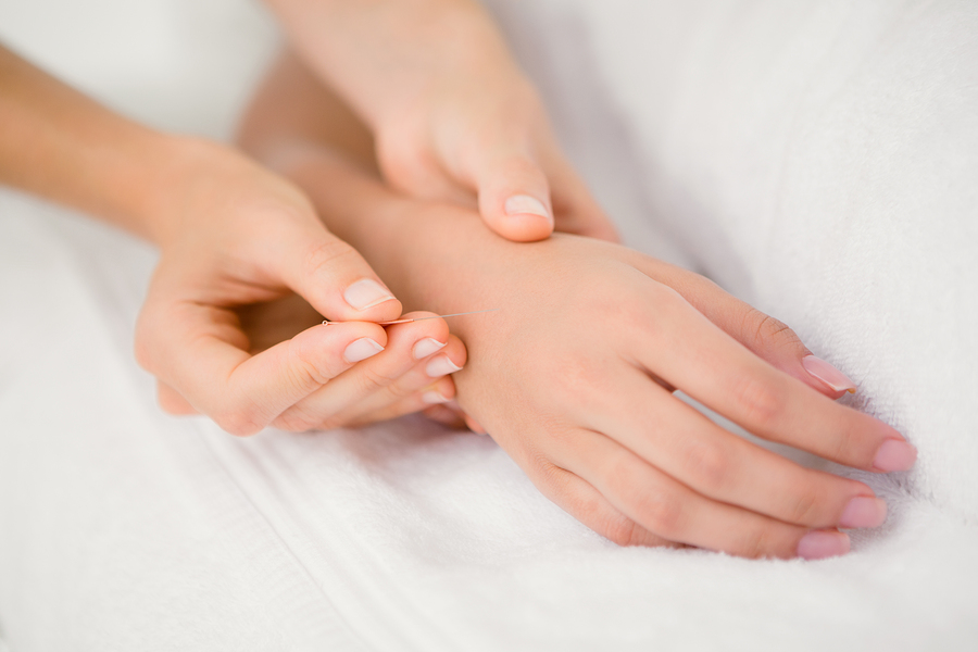 Acupuncture and Arthritis