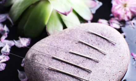 Acupuncture and Arthritis