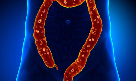 Resveratrol and Colitis
