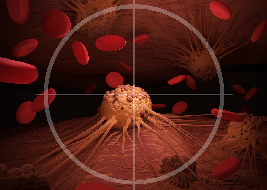Cancer and Proteolytic Enzymes