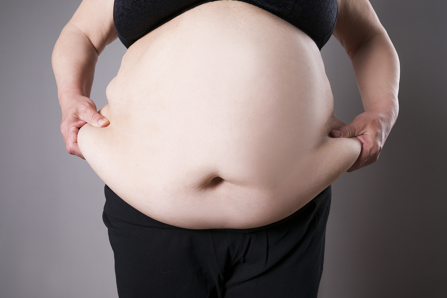 Obesity and Breast Cancer Risk