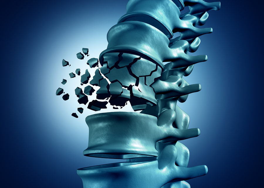Osteoporosis and Vitamin K
