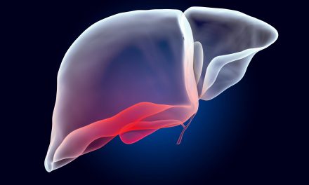 Natural & Lifestyle Support for Hepatitis C: A Look Back — and What’s New